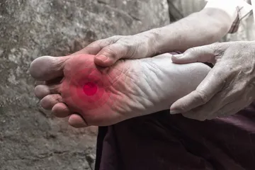 Neuropathie verstehen und wie Homöopathie helfen kann